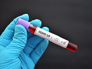 corona-virus7